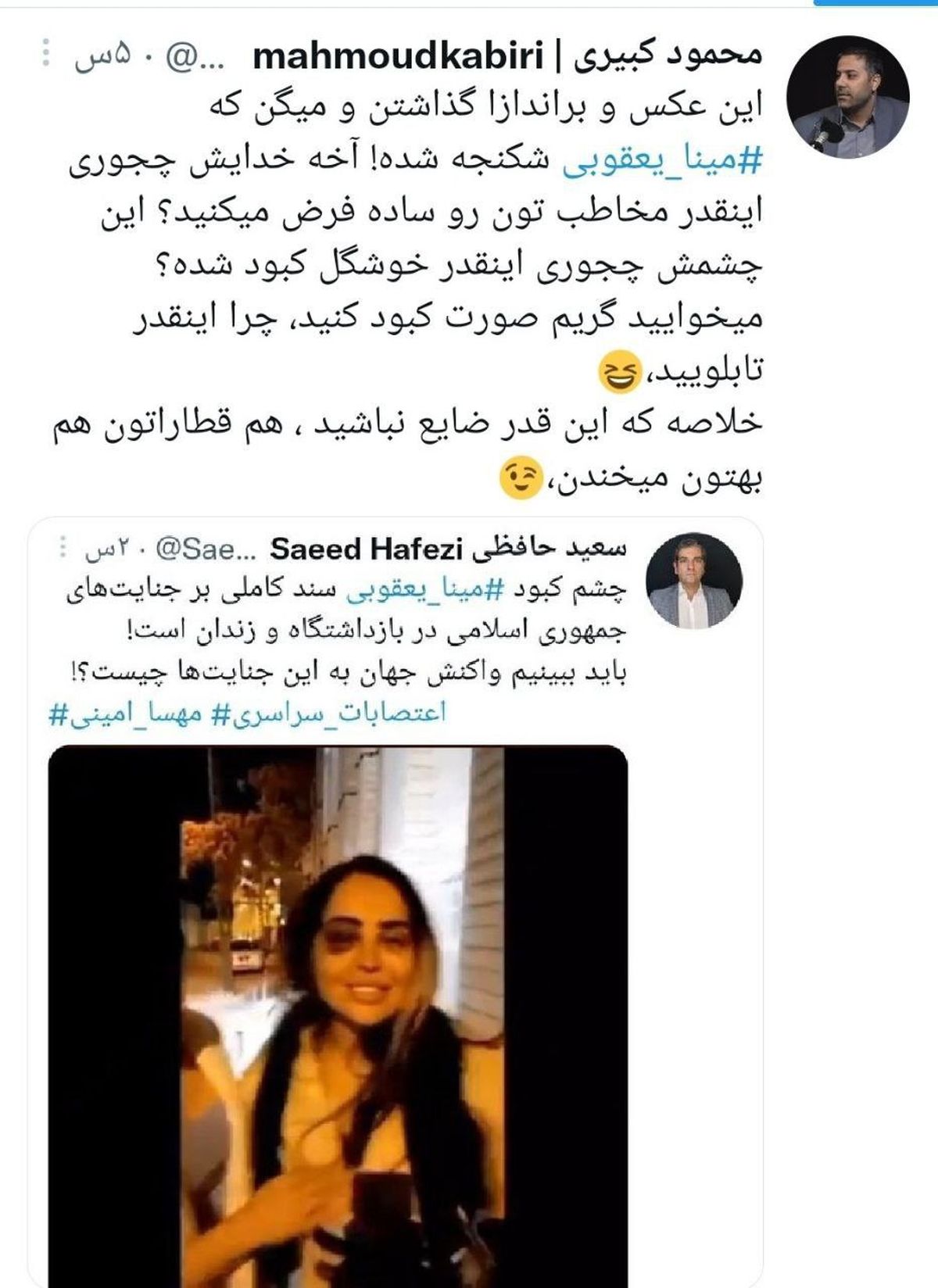 واکنش به کبودی چشم مینا یعقوبی: گریم است!